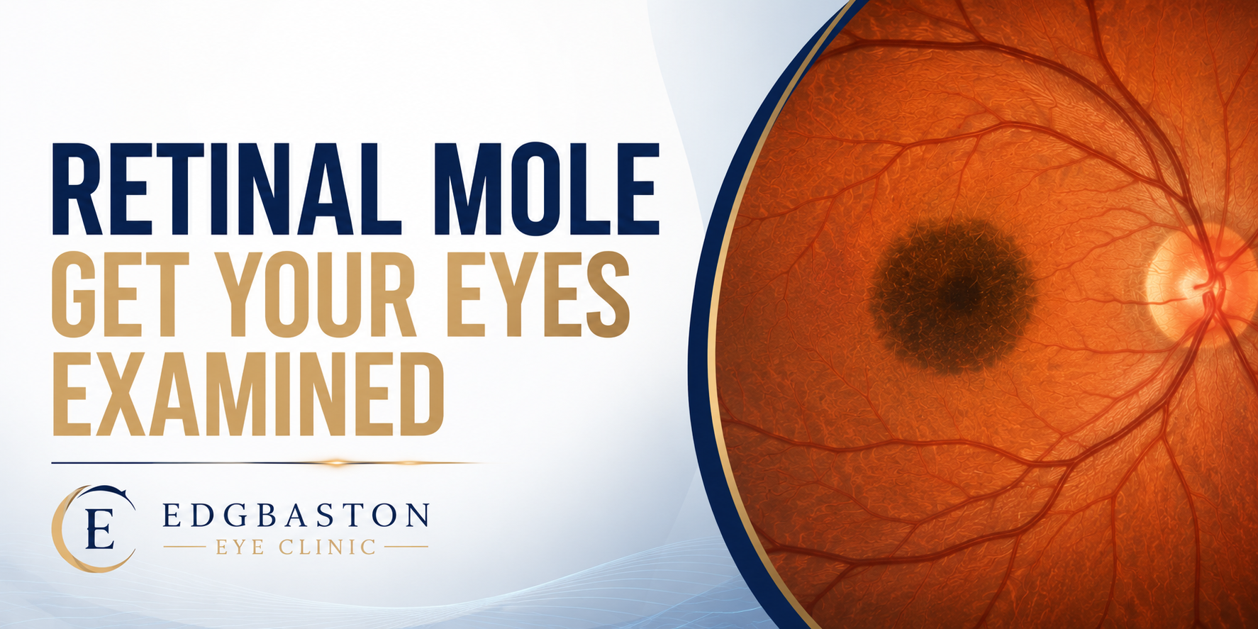 Retinal Mole